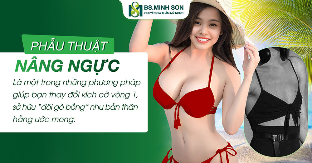 phau thuat nang nguc