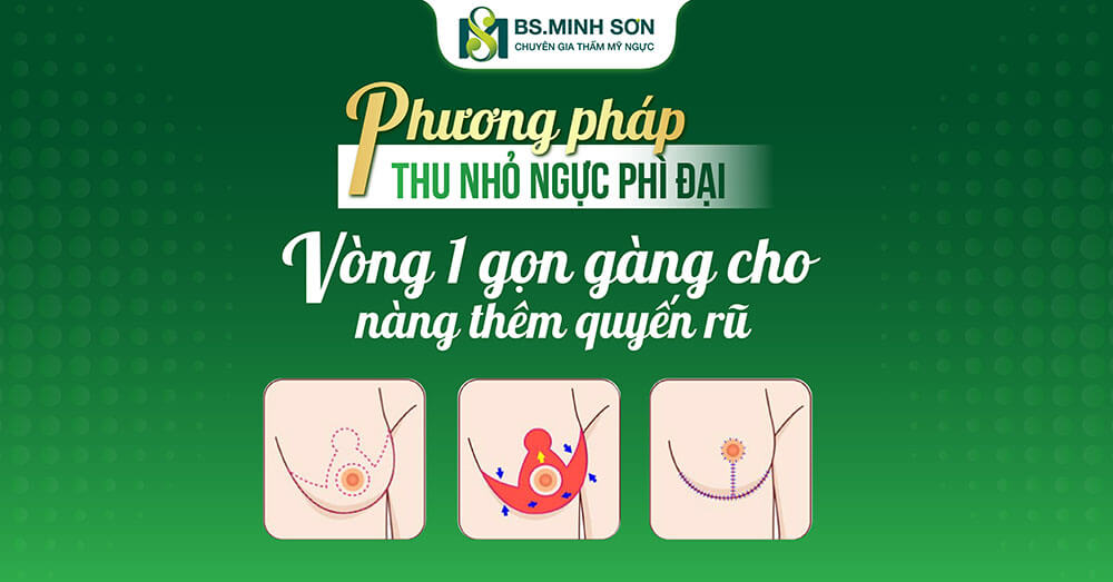 thu gon nguc phi dai