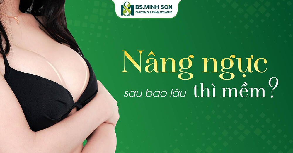 Thời gian vòng 1 mềm mại sau khi nâng ngực