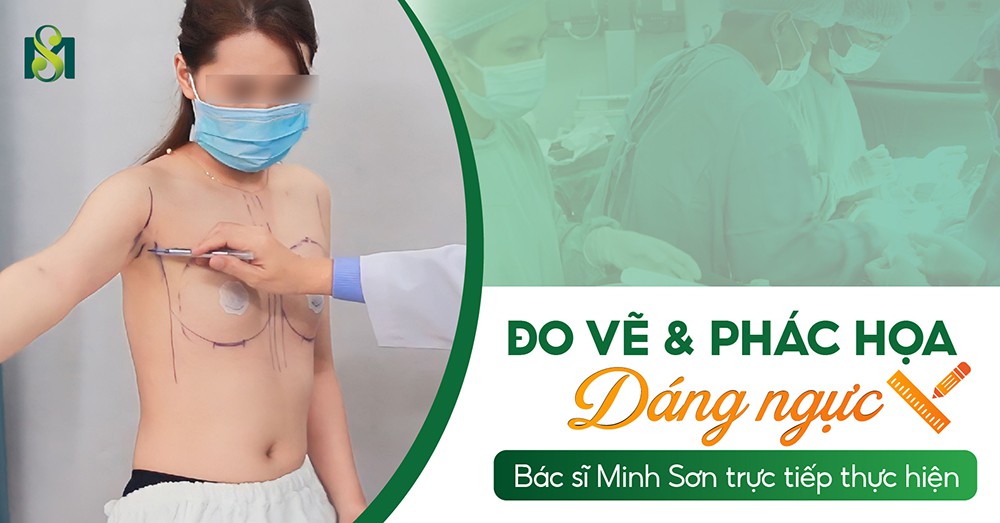 Đo và vẽ phác họa dáng ngực