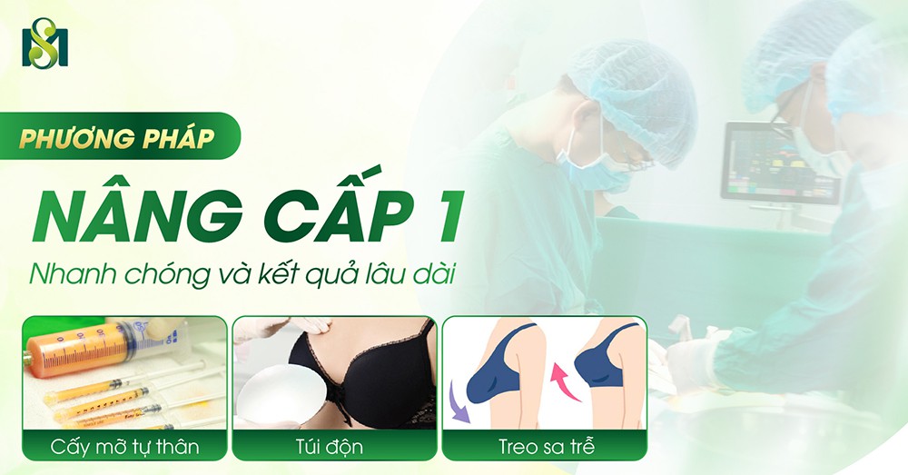 Phương pháp nâng cấp vòng 1 nhanh chóng và kết quả lâu dài