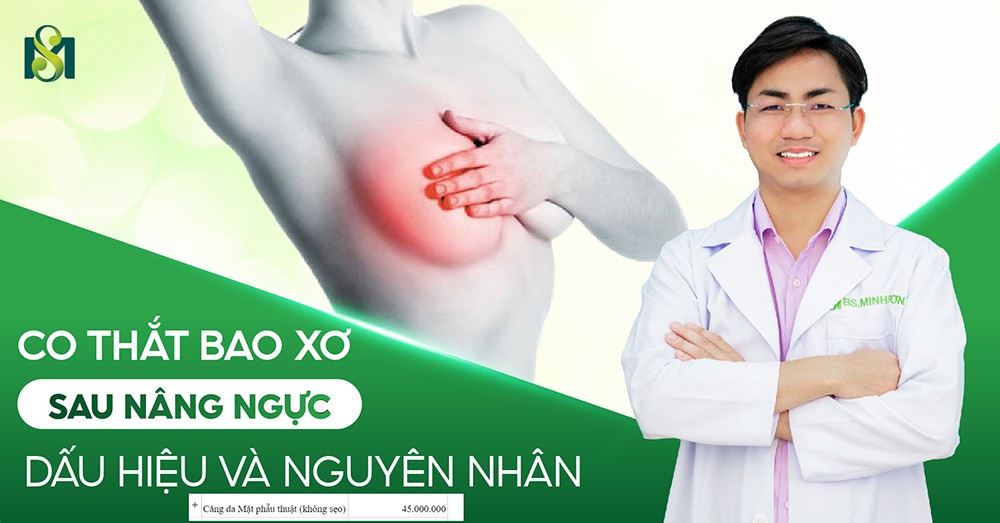 Co thắt bao xơ sau nâng ngực