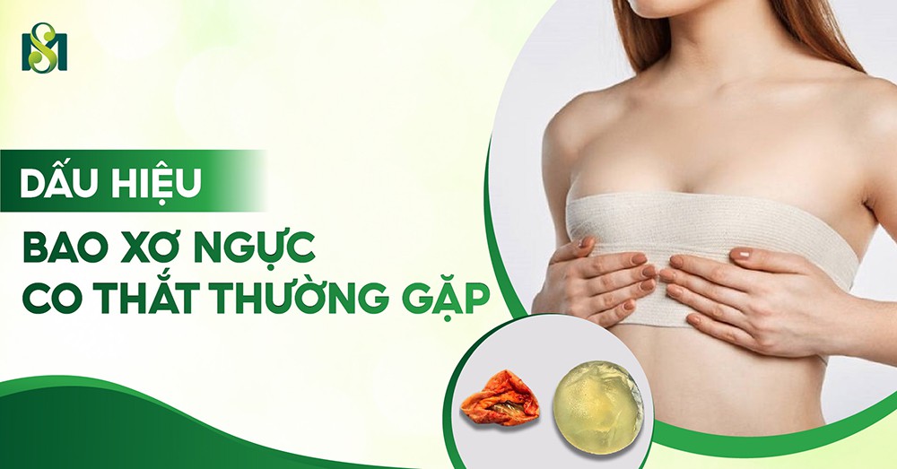 Dấu hiệu bao xơ ngực co thắt thường gặp