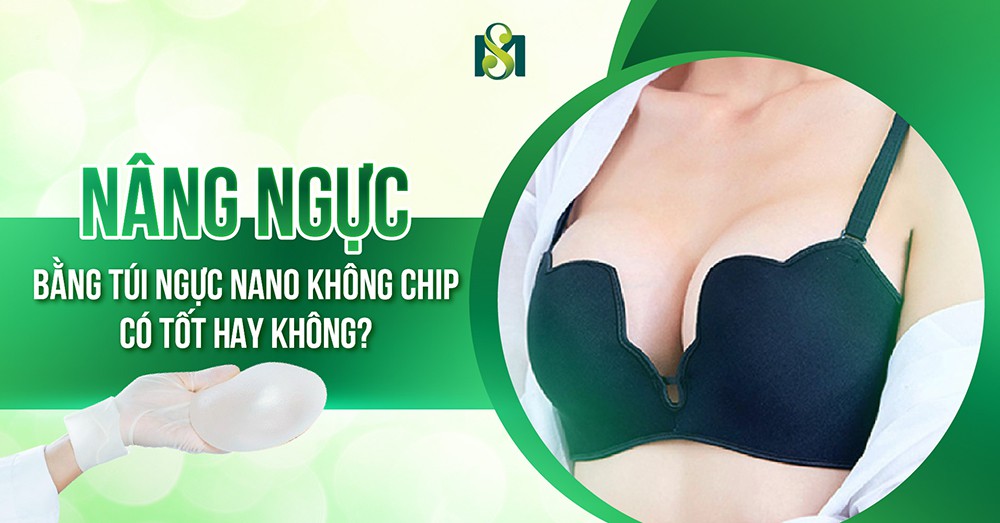 Nâng ngực bằng túi nano không chip có tốt không