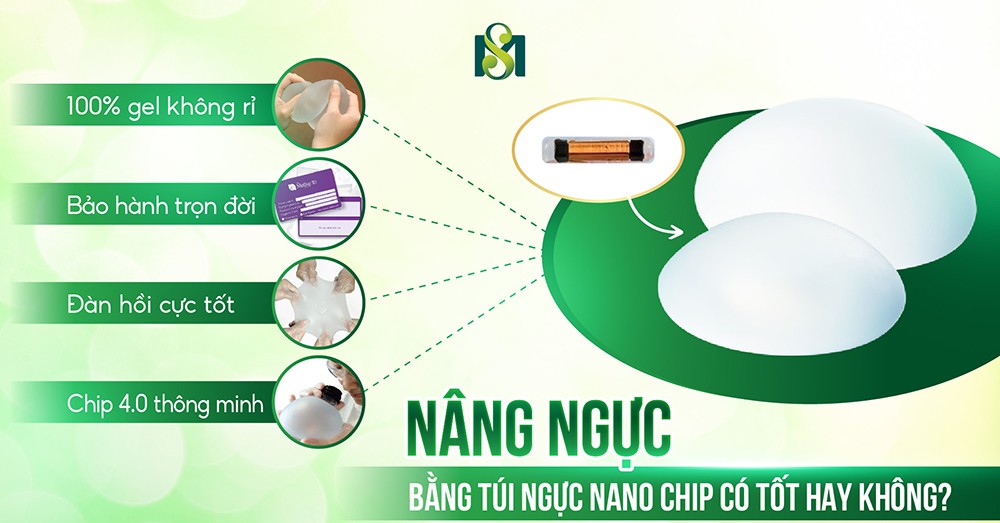 Nâng ngực bằng túi ngực nano chip có tốt hay không