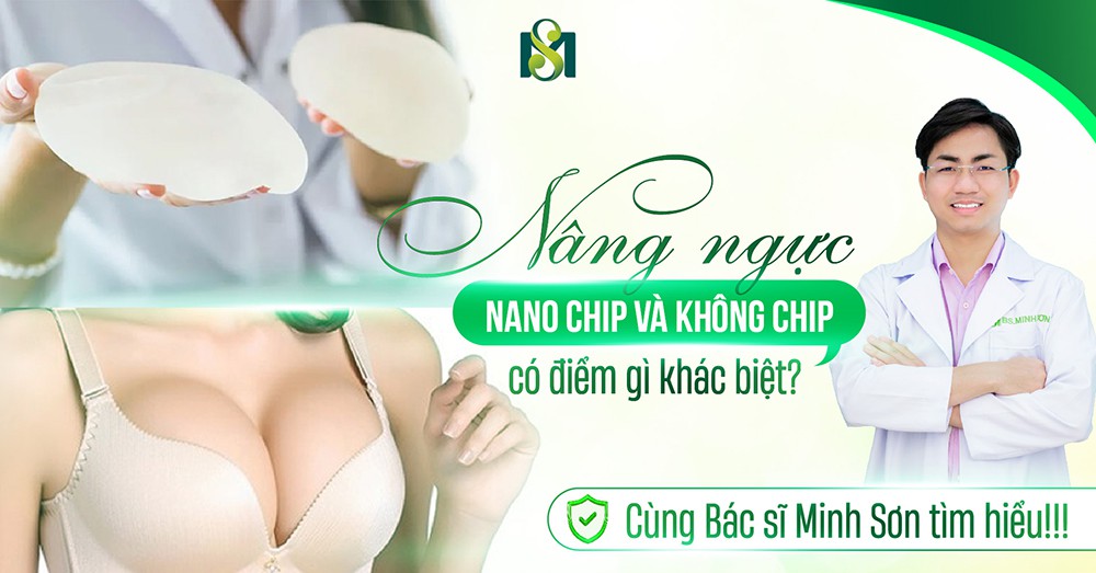 Nâng ngực Nano chip và không chip có điểm gì khác biệt