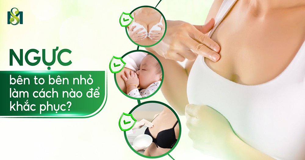Ngực bên to bên nhỏ làm cách nào để khắc phục