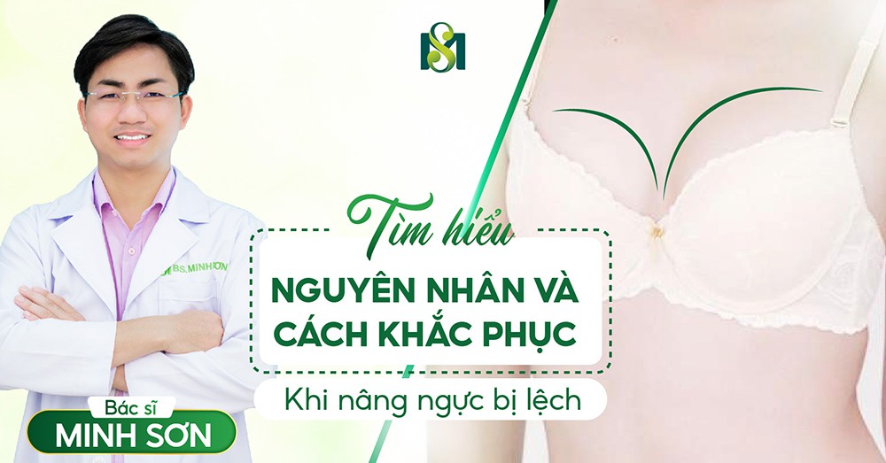 Tìm hiểu nguyên nhân và cách khắc phục khi nâng ngực bị lệch